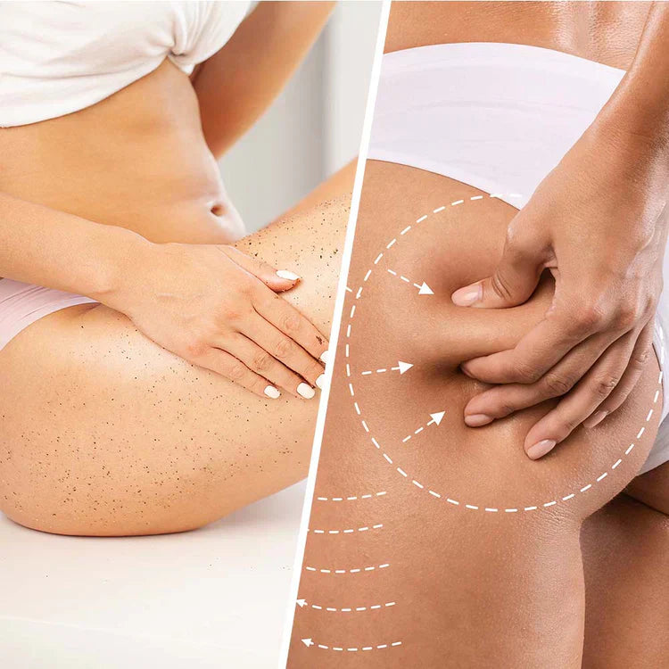 Niacin Anti-Cellulite Scrub s kokosem pro zpevňování a vyhlazení kůže 250 ml