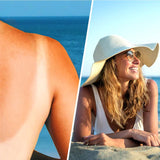 Spray de loción relajante con ácido hialurónico después del sol - 200 ml