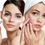 Clear Balance – Moisturizing face cream against pimples and imperfections with niacinamide 50 ml
