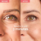 Remescar Instant Wrinkle Corrector - Διορθωτής ρυτίδων με άμεση επίδραση (180 εφαρμογές)